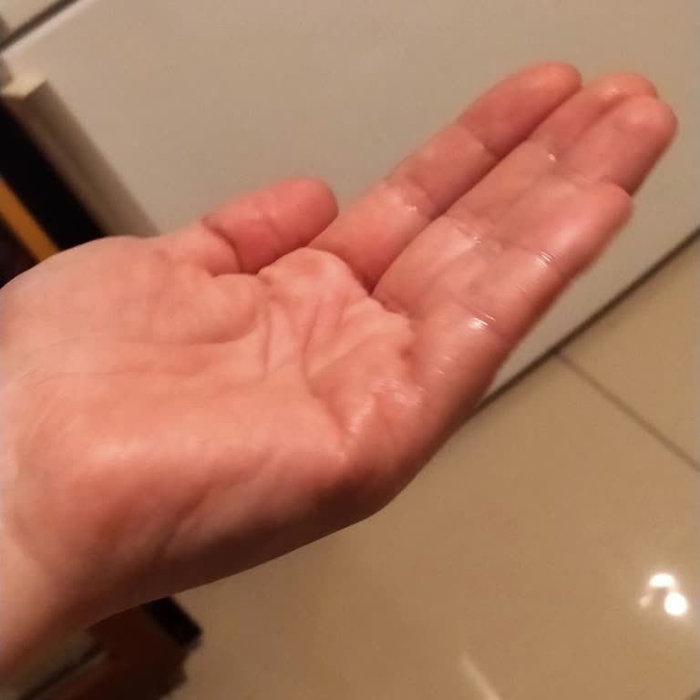 Geciken Lazer Siparişi Mağduriyeti