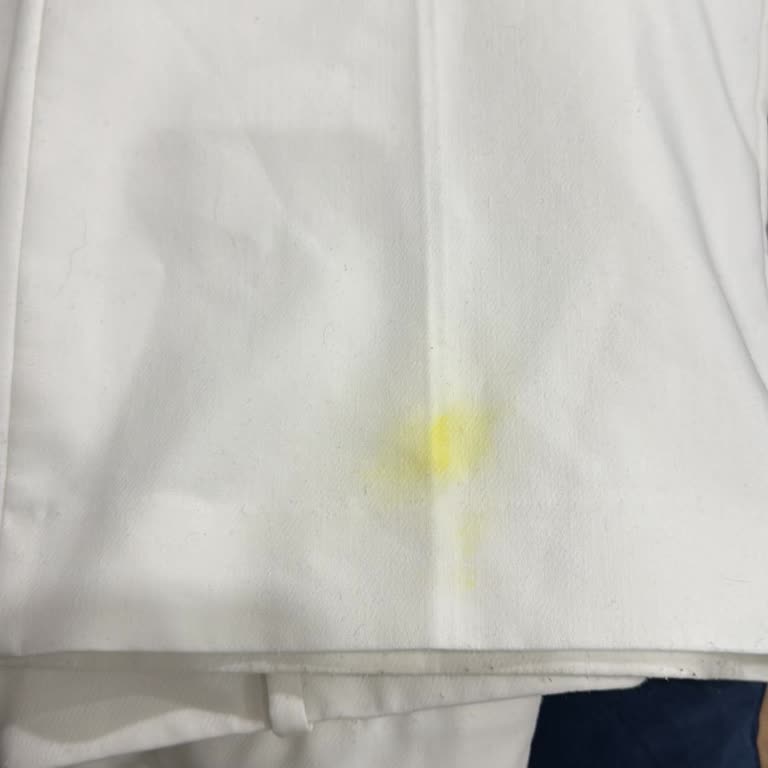 Zara'dan Alınan Pantolonun Kalite Sorunları