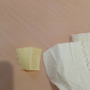 Prima Bebek Bezlerinde Yapışkan Sorunu