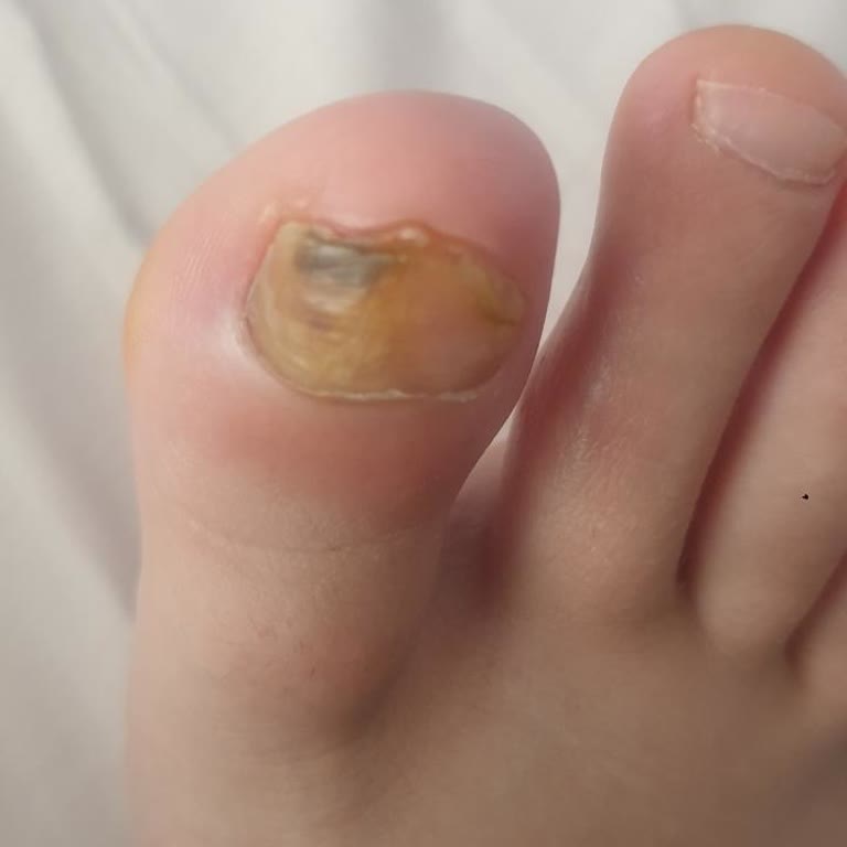 Aile Sağlığı Merkezleri Yetersiz Hizmet