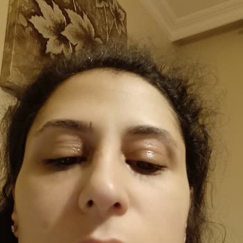 Ducray Dexyane Med Eye Cream Caused Redness, Itching & Swelling