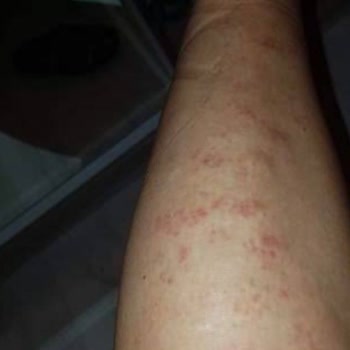 Uzunay Güzellik Salonu Kolumu Yaktı