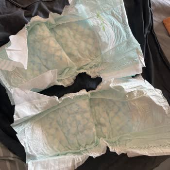 Prima Bebek Bezi: Kalite Farkı Ve Pişik Sorunu