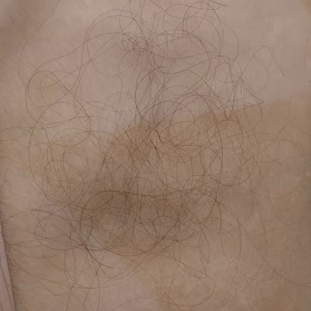 Vichy Dercos Energy Shampoo Increased Hair Loss