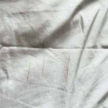 Lekeli Ürünler Ve Yetersiz Müşteri Hizmeti
