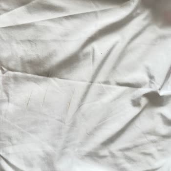 Lekeli Ürünler Ve Yetersiz Müşteri Hizmeti