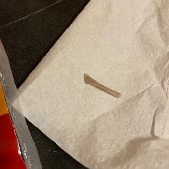 Sandviçten Çıkan Tavuk Kemiği Şoku