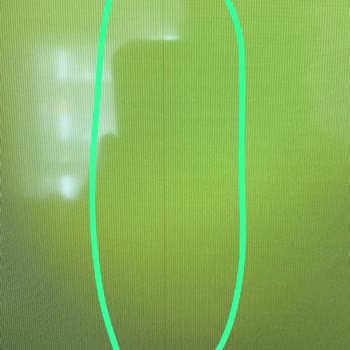 N11 Ve Media Markt Arasında Kalan Müşteri