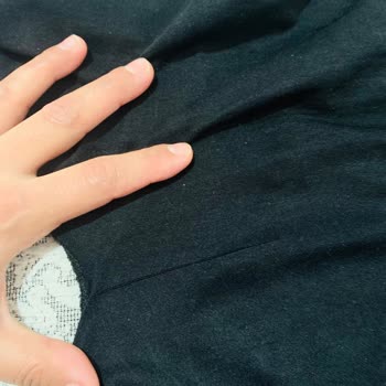 Tekrarlayan Dikiş Sorunu Ve İade Talebi