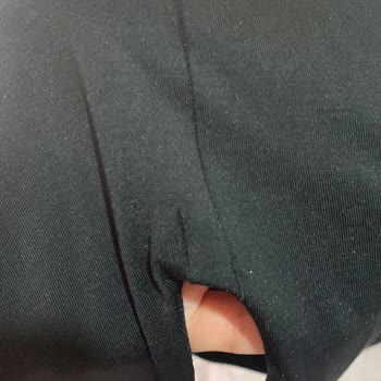 Tekrarlayan Dikiş Sorunu Ve İade Talebi