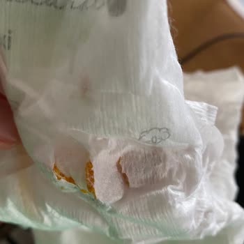 Bebek Bezinde Tehlikeli Sert Cisim