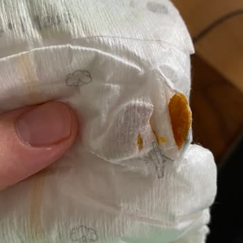 Bebek Bezinde Tehlikeli Sert Cisim