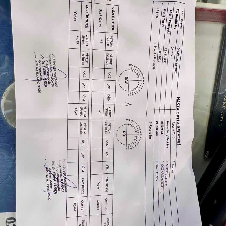 Yanlış Muayene Sonucu Göz Sağlığım Tehlikeye Girdi