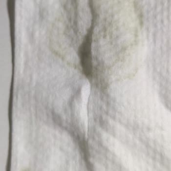 Jussy Sağlık Kalitesizliği