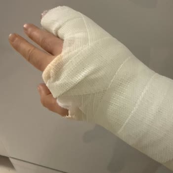 Hastane Ücretleri Ve Tedavi Sürecinde Yaşanan Sorunlar