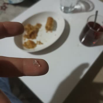 Cam Parçası İçeren Tatlı: Güvenlik Tehlikesi