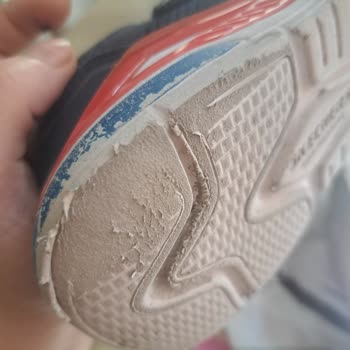 Skechers Ayakkabının Dayanıklılığı Hayal Kırıklığı Yarattı