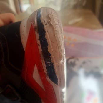 Skechers Ayakkabının Dayanıklılığı Hayal Kırıklığı Yarattı