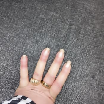 Vivense Koltuklarım Çöktü: Acil Değişim Talebi