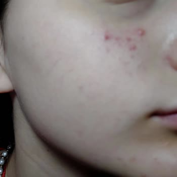 Cilt Sorunlarına Yol Açan CC Krem