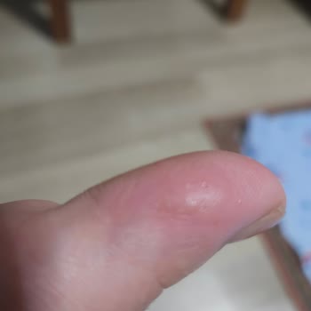 Ayakkabı Rahatsızlığına Çözüm Bulunamıyor