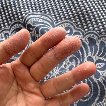 Vanish Beyaz Leke Çıkarıcı Ellerimi Yaktı