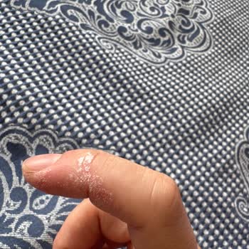 Vanish Beyaz Leke Çıkarıcı Ellerimi Yaktı