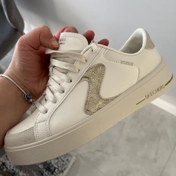 Skechers Ayakkabıları Ayaklarımı Yaraladı!