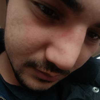 Atasun Optik'ten Aldığım Gözlük Burnumu Yaraladı