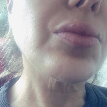 Estetik Merkezinde Kötü Deneyim Ve İade Sorunu