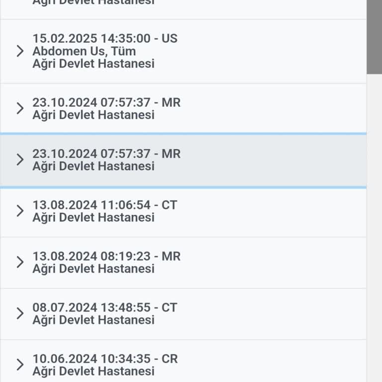 MR Sonuçlarının Gecikmesi