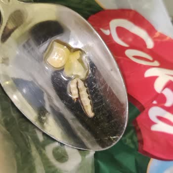 A101 Dondurulmuş Mısırda Yabancı Madde Sorunu