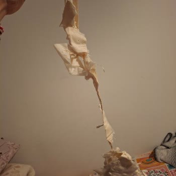 Bebek Bezinde Güven Sarsan Yabancı Madde