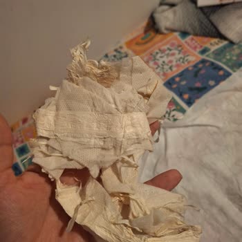 Bebek Bezinde Güven Sarsan Yabancı Madde