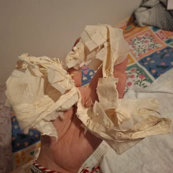 Bebek Bezinde Güven Sarsan Yabancı Madde