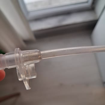 Pipetli Sulukta Temizlik Sorunu Ve İletişim Eksikliği