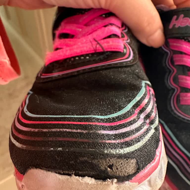 Skechers Ayakkabının Hızla Deformasyonu Ve Müşteri Hayal Kırıklığı