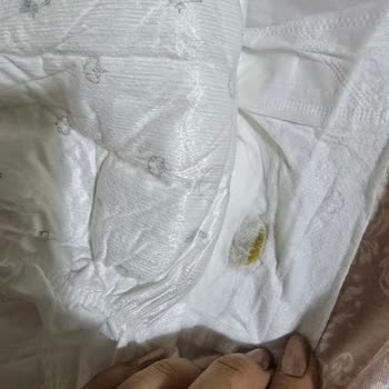 Sleepy Bebek Bezinden Çıkan Şaşırtıcı Sert Cisim