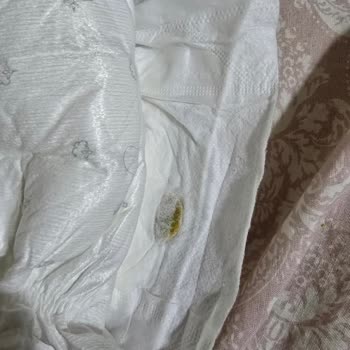 Sleepy Bebek Bezinden Çıkan Şaşırtıcı Sert Cisim
