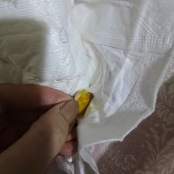 Sleepy Bebek Bezinden Çıkan Şaşırtıcı Sert Cisim