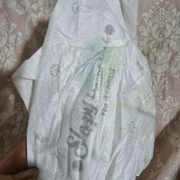 Sleepy Bebek Bezinden Çıkan Şaşırtıcı Sert Cisim