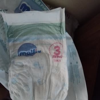 Molfix Premium Bebek Bezinde Kimyasal Koku Skandalı