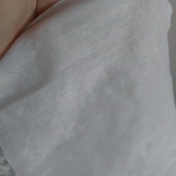 Sleepy Kuru Mendil Kabusu: Bebeğimin Cildi Tehlikede!