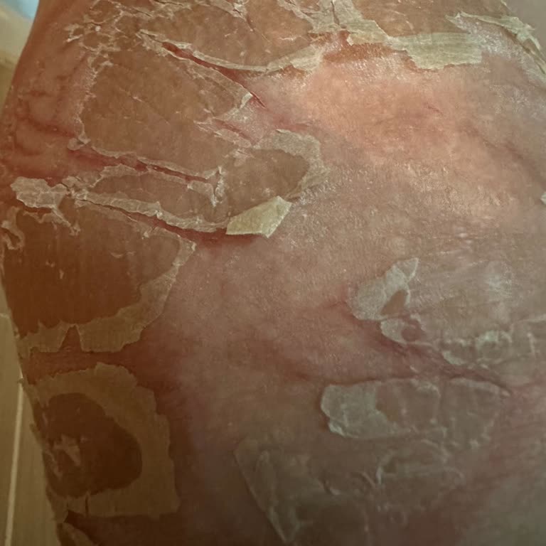 Kars Şubesinde Yapılan Çatlak Onarımı Yanıkla Sonuçlandı