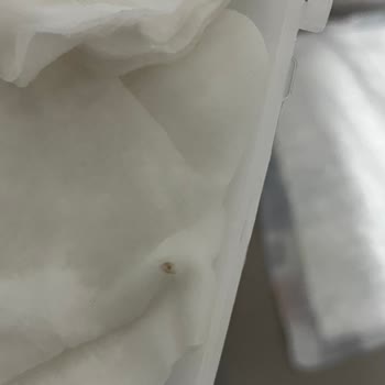 Wee Baby Bebek Temizleme Pamuğu Hijyen Sorunu