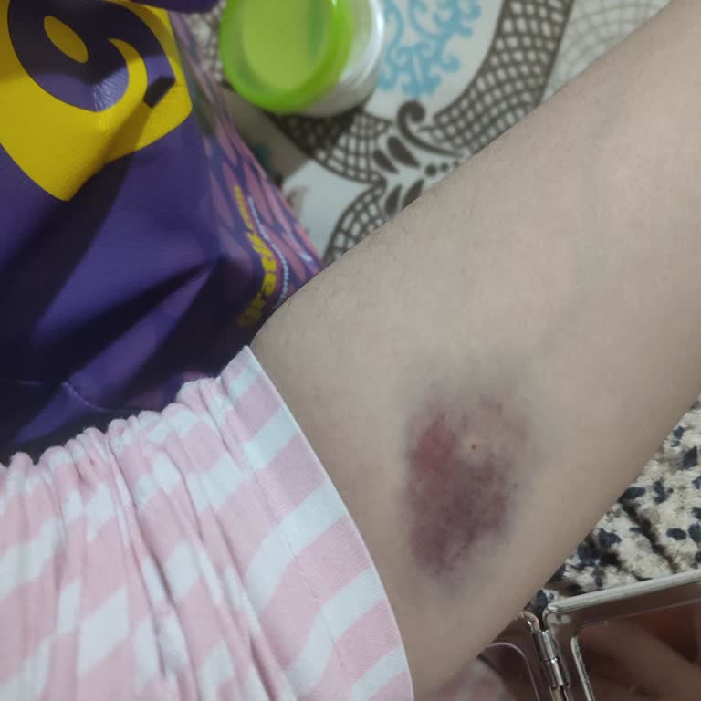 Hastanede İlgisizlik Ve Yanlış Tedavi Sonucu Mağduriyet