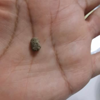 Fıstık Ezmesinden Taş Çıktı: Dişim Kırılıyordu