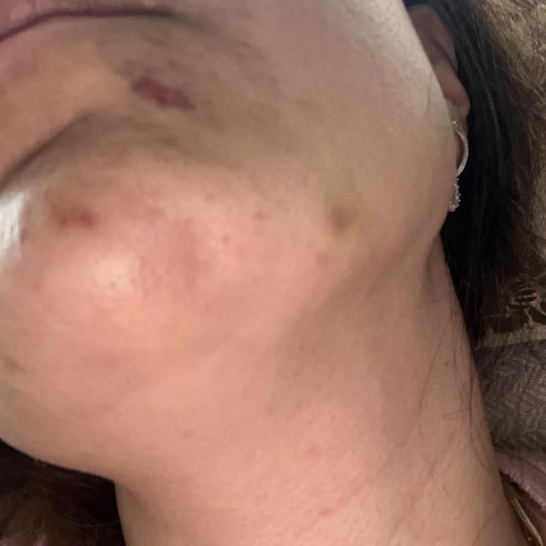 Paris Işıltısı Hayal Kırıklığı: Beklenmeyen Yan Etkiler