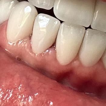 Dentasay'da Yaşanan Diş Tedavisi Kabusu