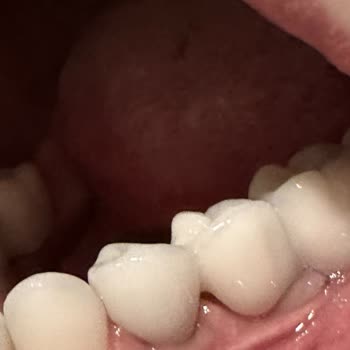 Dentasay'da Yaşanan Diş Tedavisi Kabusu